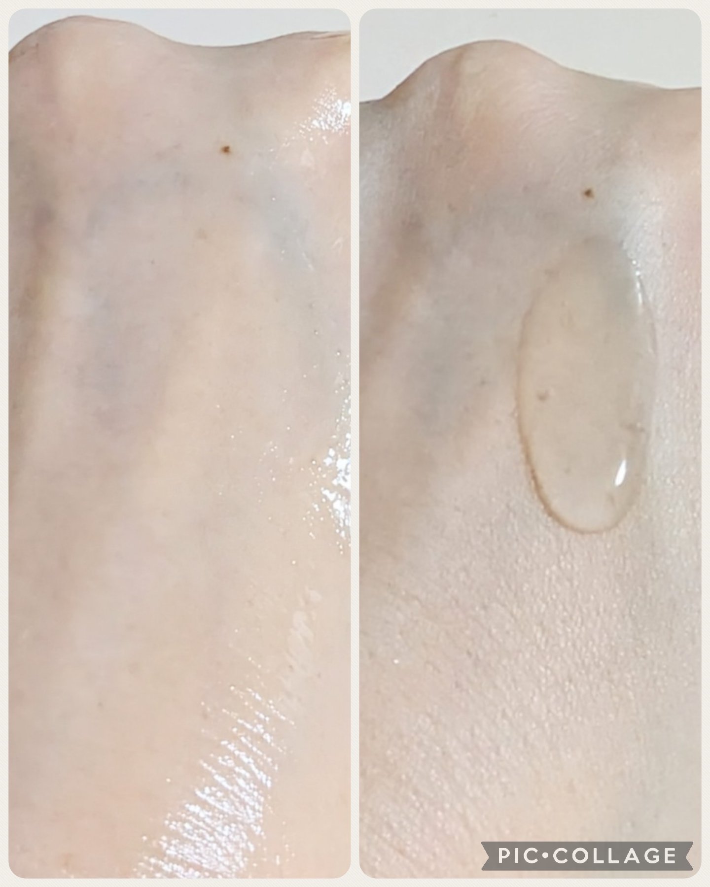 ビタ3セラム/オーズナリー/美容液を使ったクチコミ（3枚目）