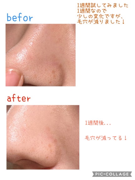 AZ20フェイスクリーム/SUKUUS/フェイスクリームを使ったクチコミ(3枚目)