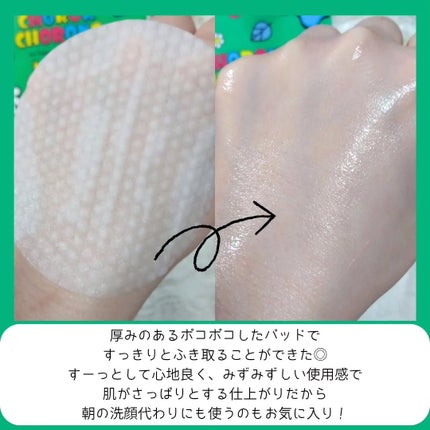 ペパーミントトナーパッド/CHOROK CHORONG/トナーパッドを使ったクチコミ(4枚目)