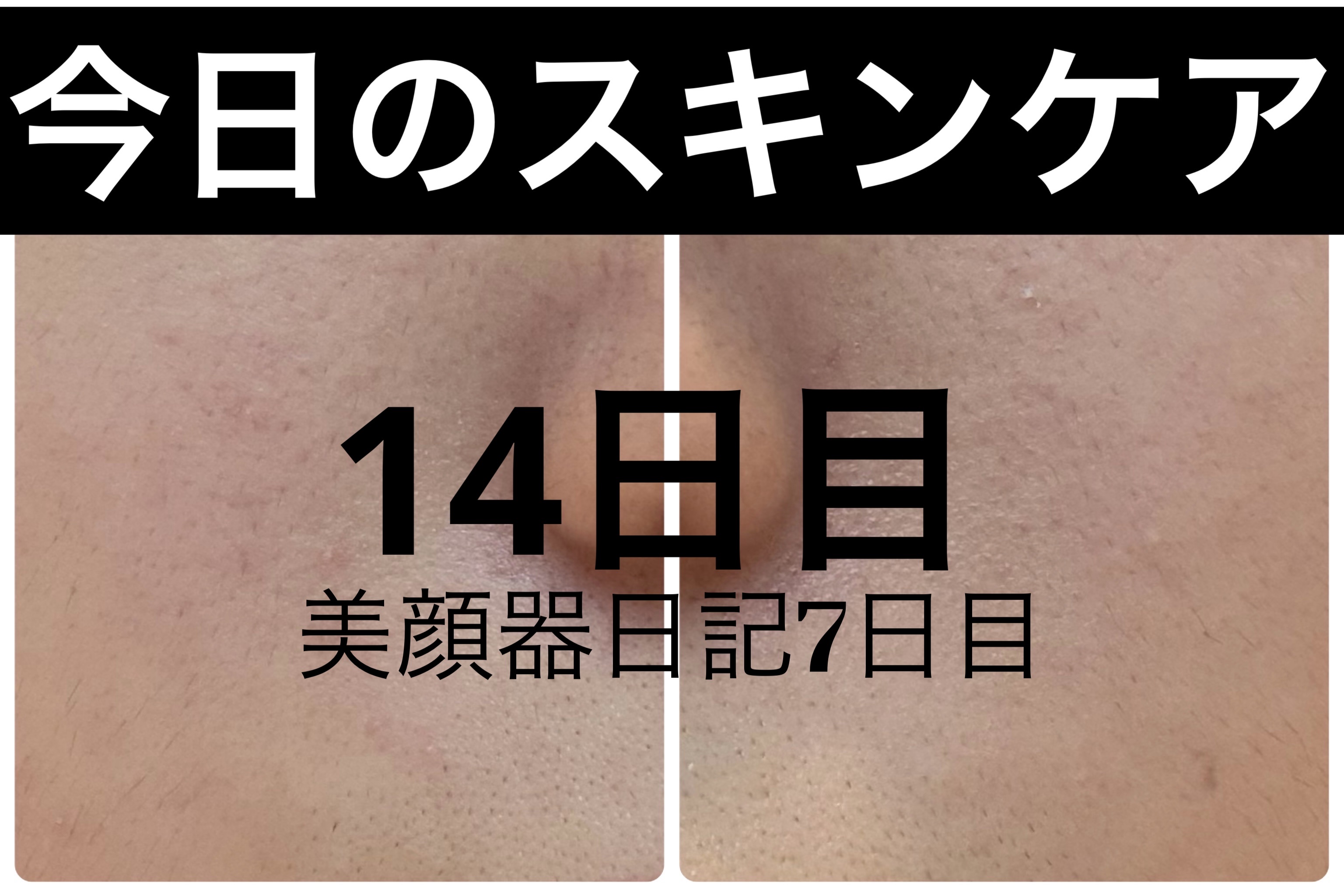 エターナルアイクリーム/リュバンブラン/アイケア・アイクリームを使ったクチコミ（1枚目）