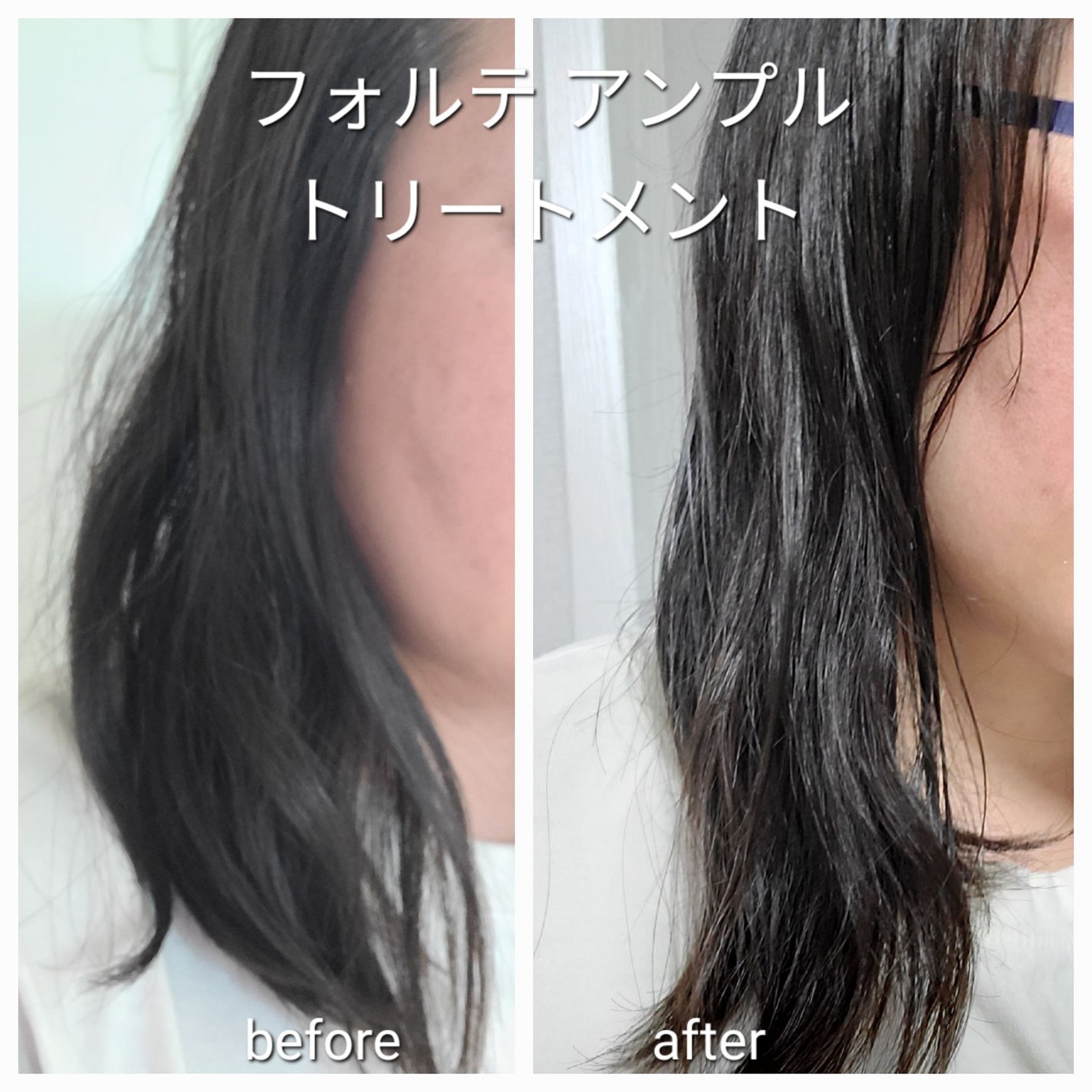 フォルテ アンプル トリートメント/treecell/洗い流すヘアトリートメントを使ったクチコミ(7枚目)