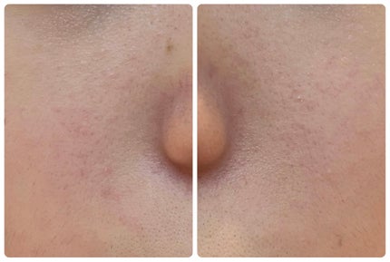 エターナルアイクリーム 8g/リュバンブラン/アイケア・アイクリームを使ったクチコミ(3枚目)