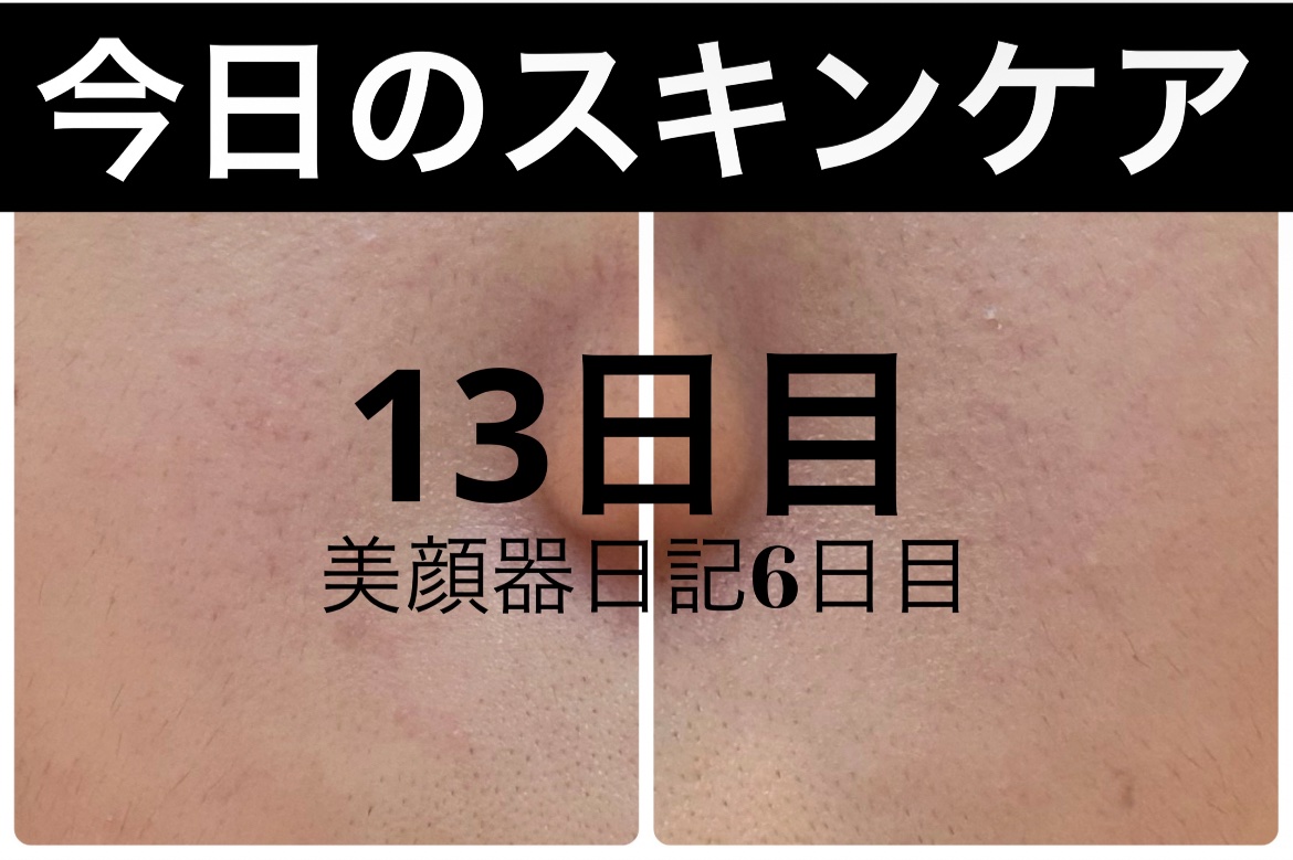 ディープブーストセラム/ブルーミオ/美容液を使ったクチコミ（1枚目）