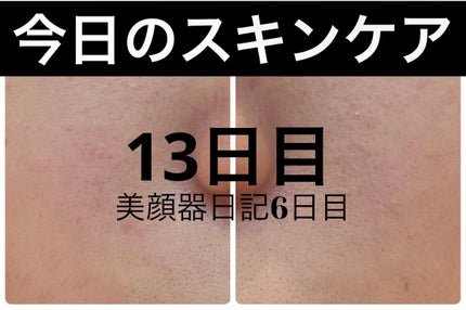 エターナルアイクリーム 8g/リュバンブラン/アイケア・アイクリームを使ったクチコミ(1枚目)