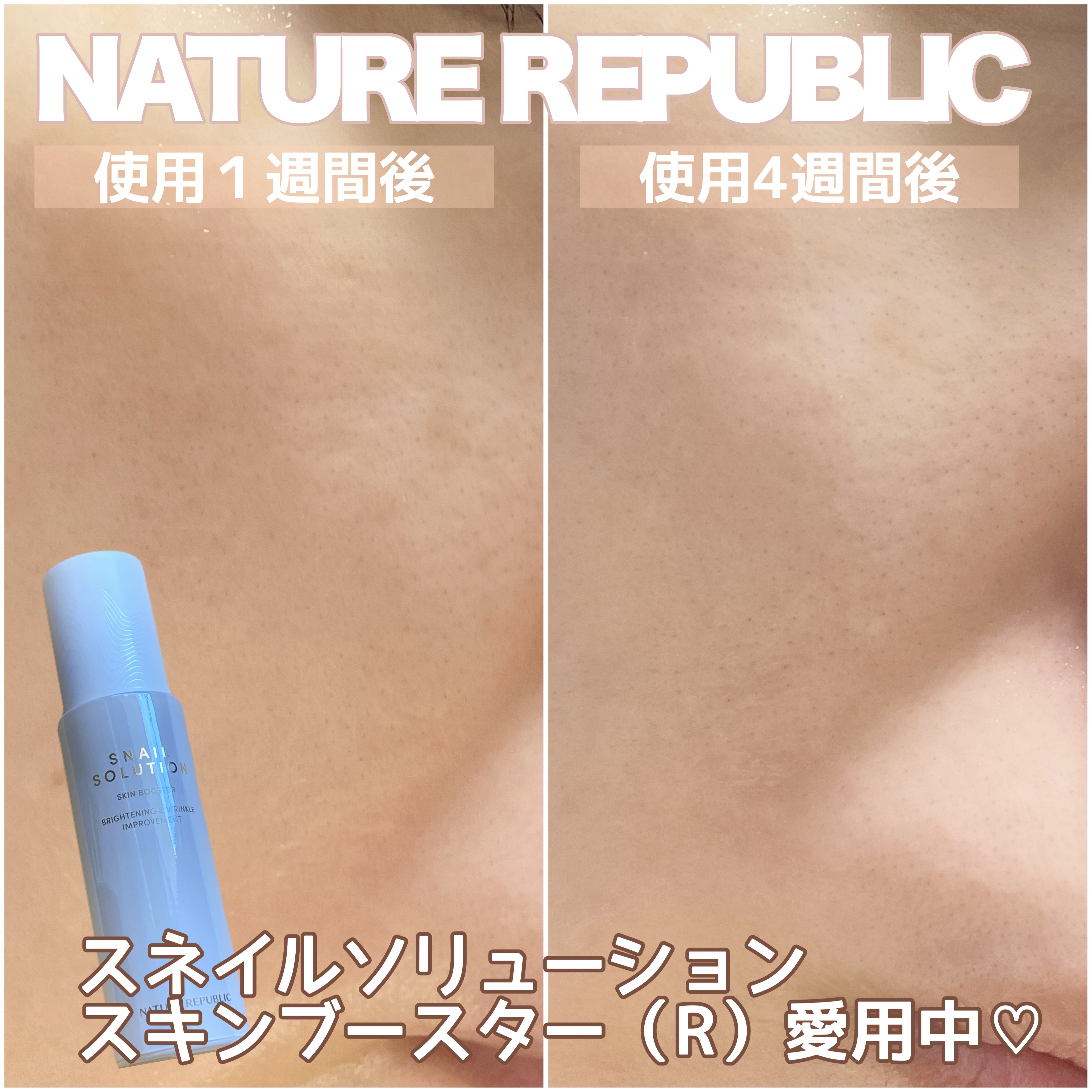スネイルソリューション スキンブースター(R)/ネイチャーリパブリック/ブースター・導入液を使ったクチコミ（2枚目）