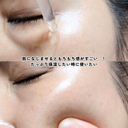 REJURAN デュアルエフェクトアンプル 30ml/REJURAN COSMETICS/美容液を使ったクチコミ(5枚目)