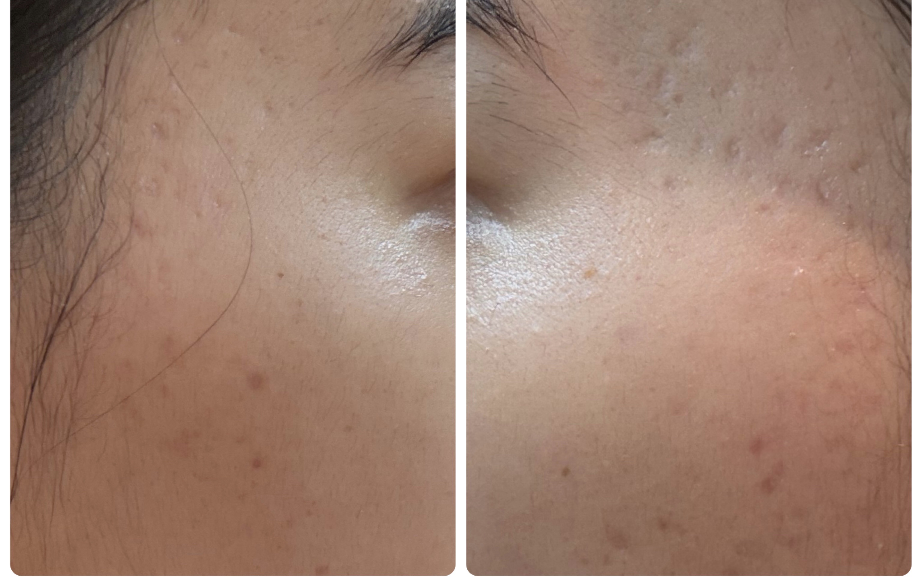 エターナルアイクリーム/リュバンブラン/アイケア・アイクリームを使ったクチコミ（2枚目）