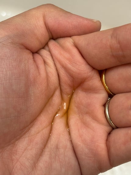 Cコントロールリペアセラム/ドクターケイ/美容液を使ったクチコミ(2枚目)