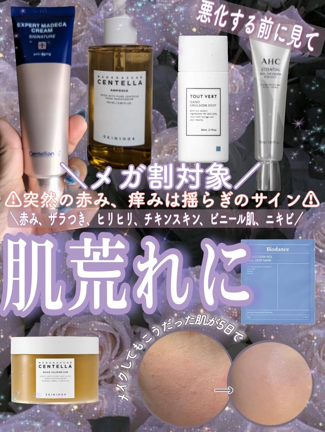 トリートメントリッチフォーム/エトヴォス/泡洗顔を使ったクチコミ（1枚目）