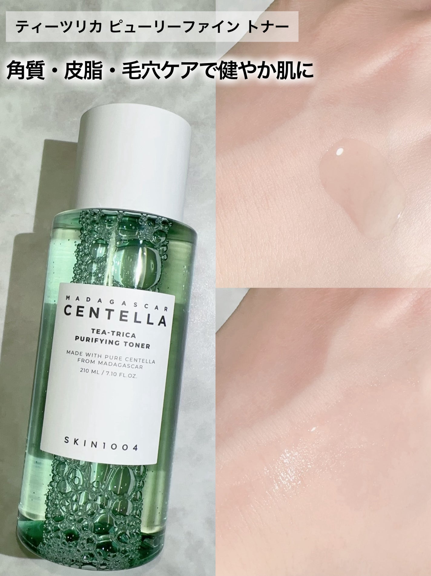 センテラ トーニングトナー/SKIN1004/化粧水を使ったクチコミ(6枚目)