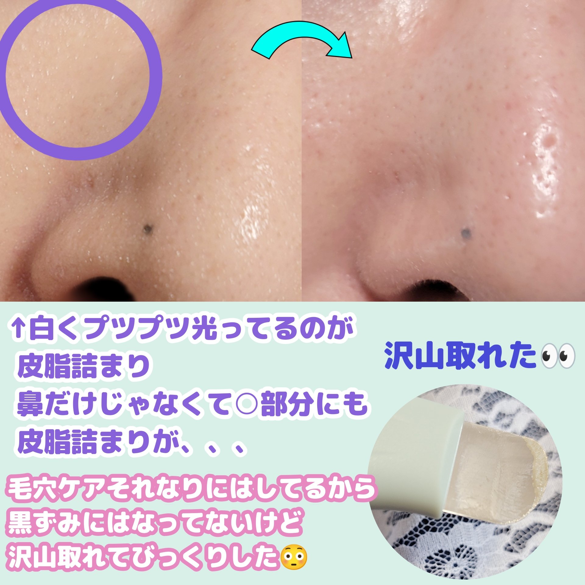 ディープクリーンマスター/ilso/その他スキンケアグッズを使ったクチコミ（3枚目）