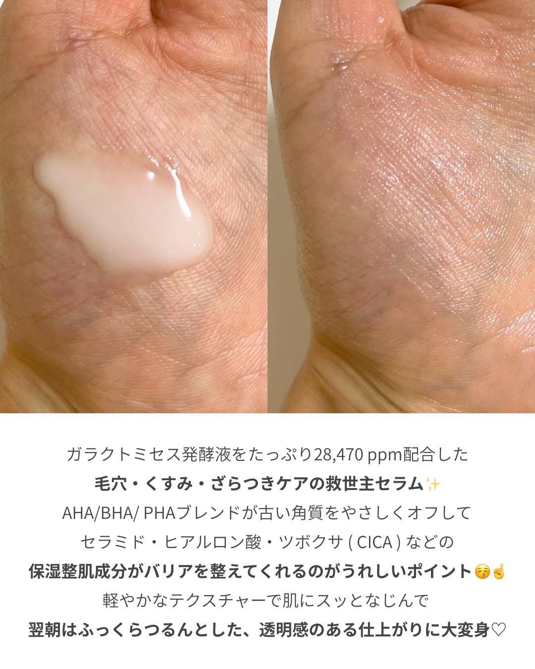 サミュ ガラクトポア セラム/SAM'U/美容液を使ったクチコミ（2枚目）