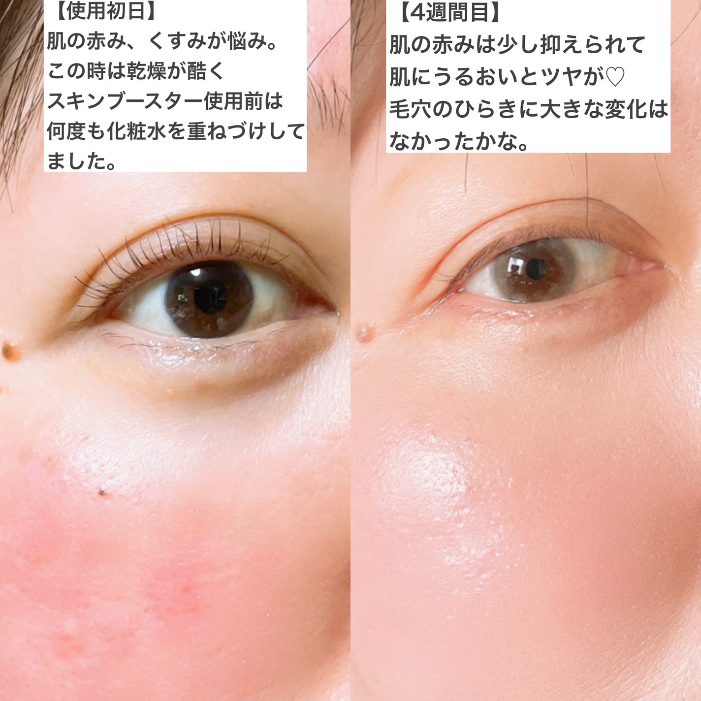 スネイルソリューション スキンブースター(R)/ネイチャーリパブリック/ブースター・導入液を使ったクチコミ(2枚目)