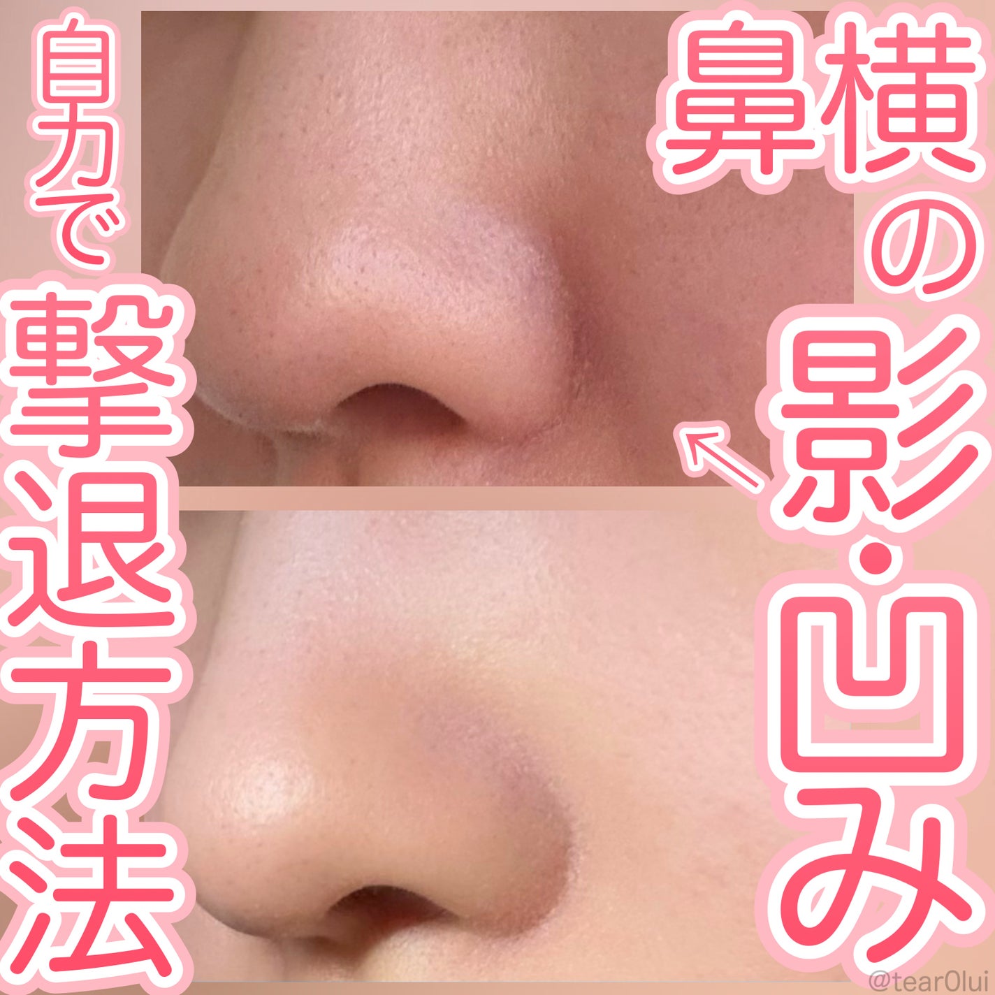 スキンプロテクトベース<皮脂くずれ防止> 超オイリー肌用/プリマヴィスタ/化粧下地を使ったクチコミ(1枚目)