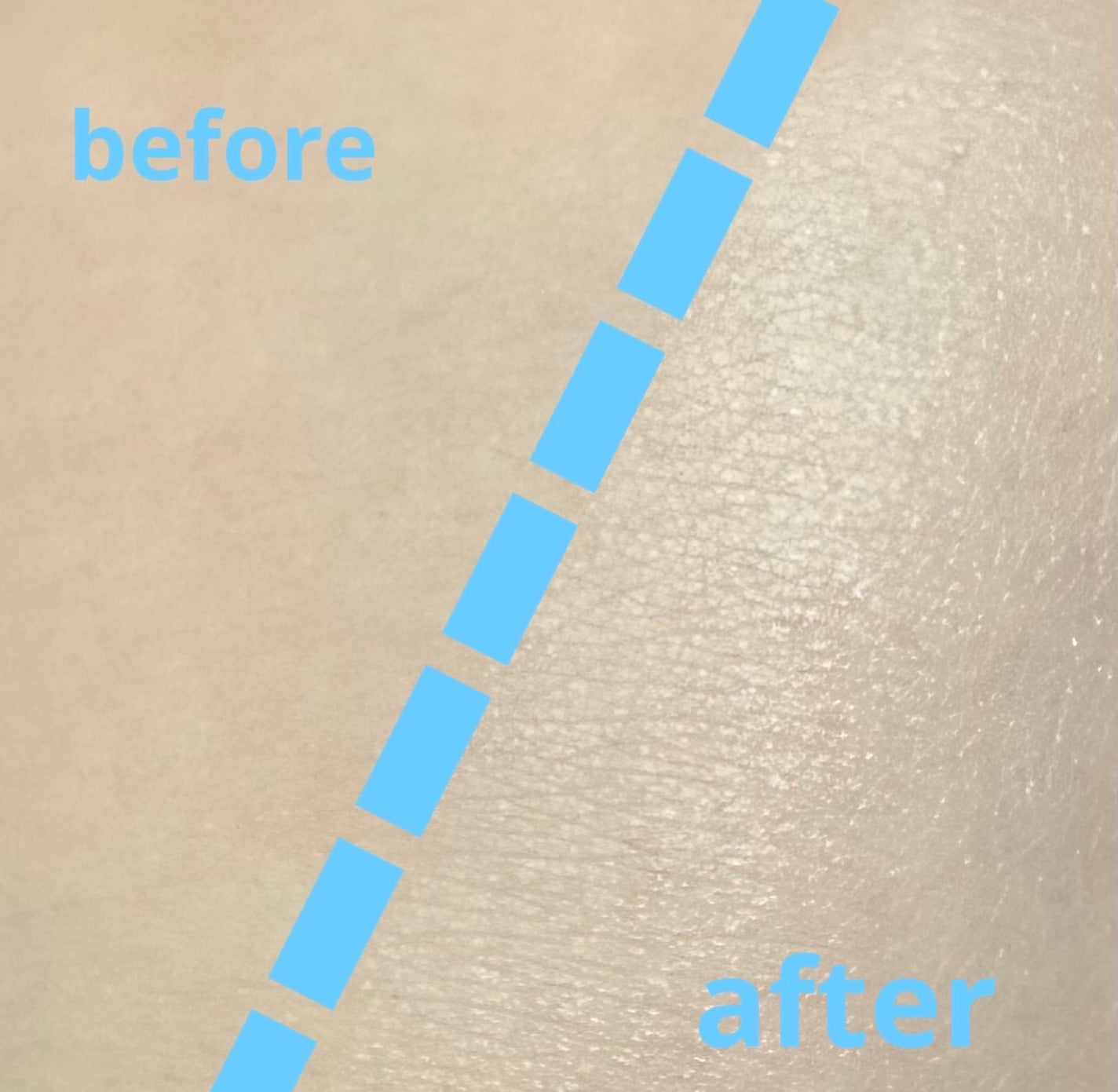 ã¡ã©ãããã¯ã/æ°Žæ©ä¿å¯¿å 補è¬/æ¥çŒãæ¢ããã«ã¯ã䜿ã£ãã¯ãã³ãïŒ6æç®ïŒ