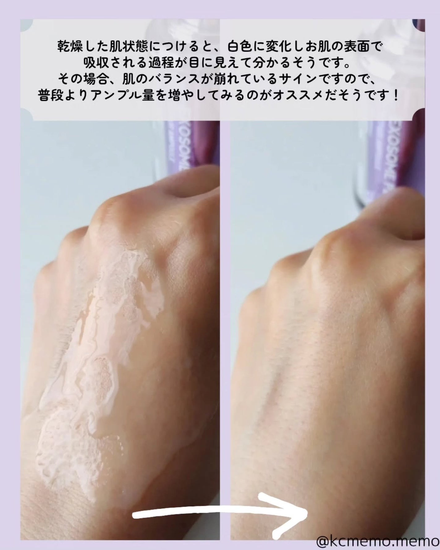 ヒアルロン ウォーターバリア サンセラム/MAXCLINIC/日焼け止めローションを使ったクチコミ(8枚目)