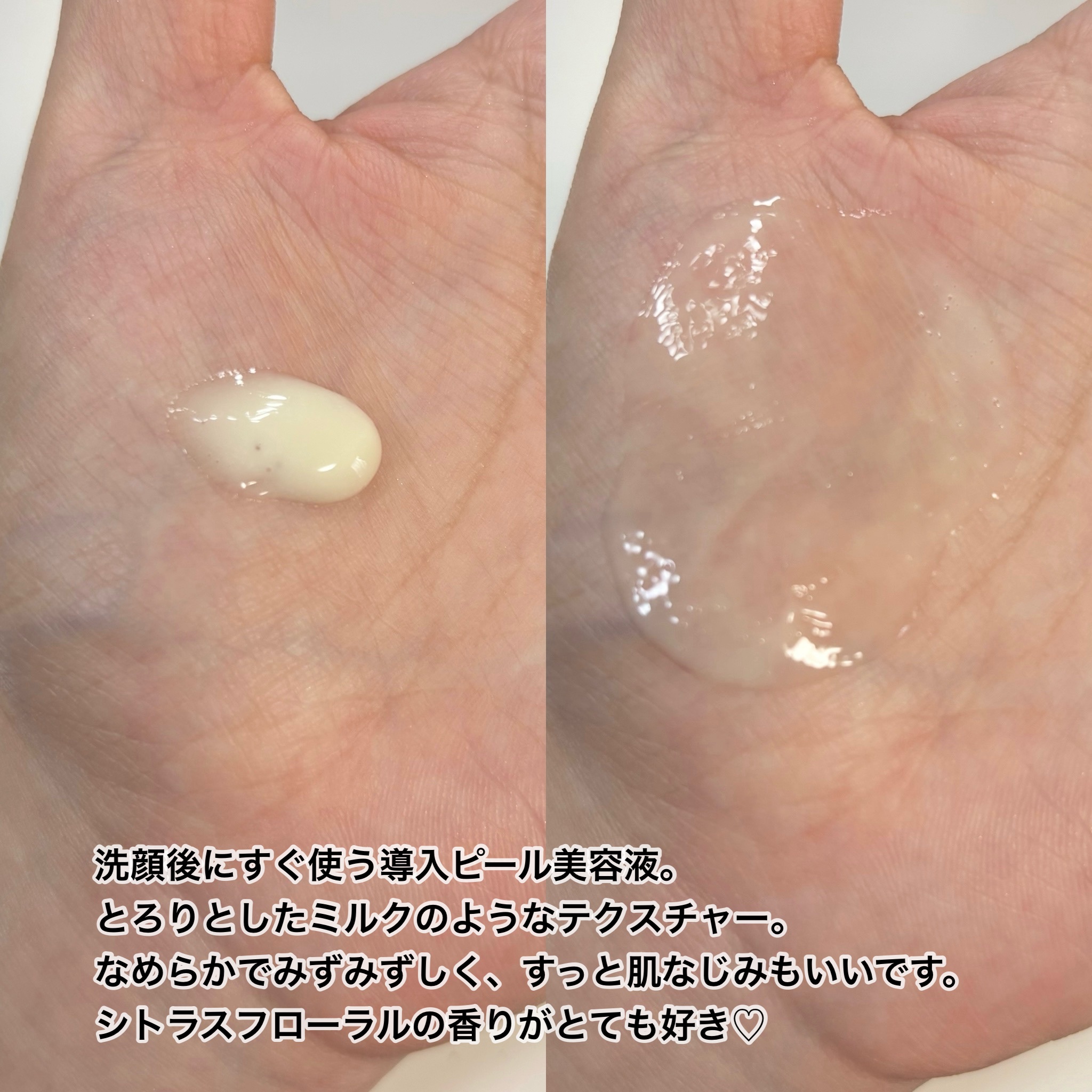 レチララ 美容液/ネイチャーリパブリック/美容液を使ったクチコミ（3枚目）