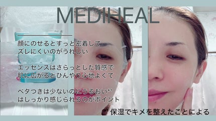 マデカソサイド ブレミッシュパッド/MEDIHEAL/トナーパッドを使ったクチコミ(4枚目)