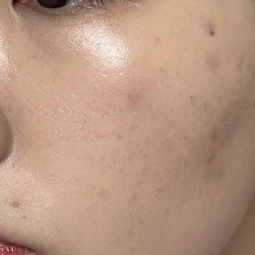 リフレクション スキン グロウ クッション ファンデーション/HERA/クッションファンデーションを使ったクチコミ(4枚目)