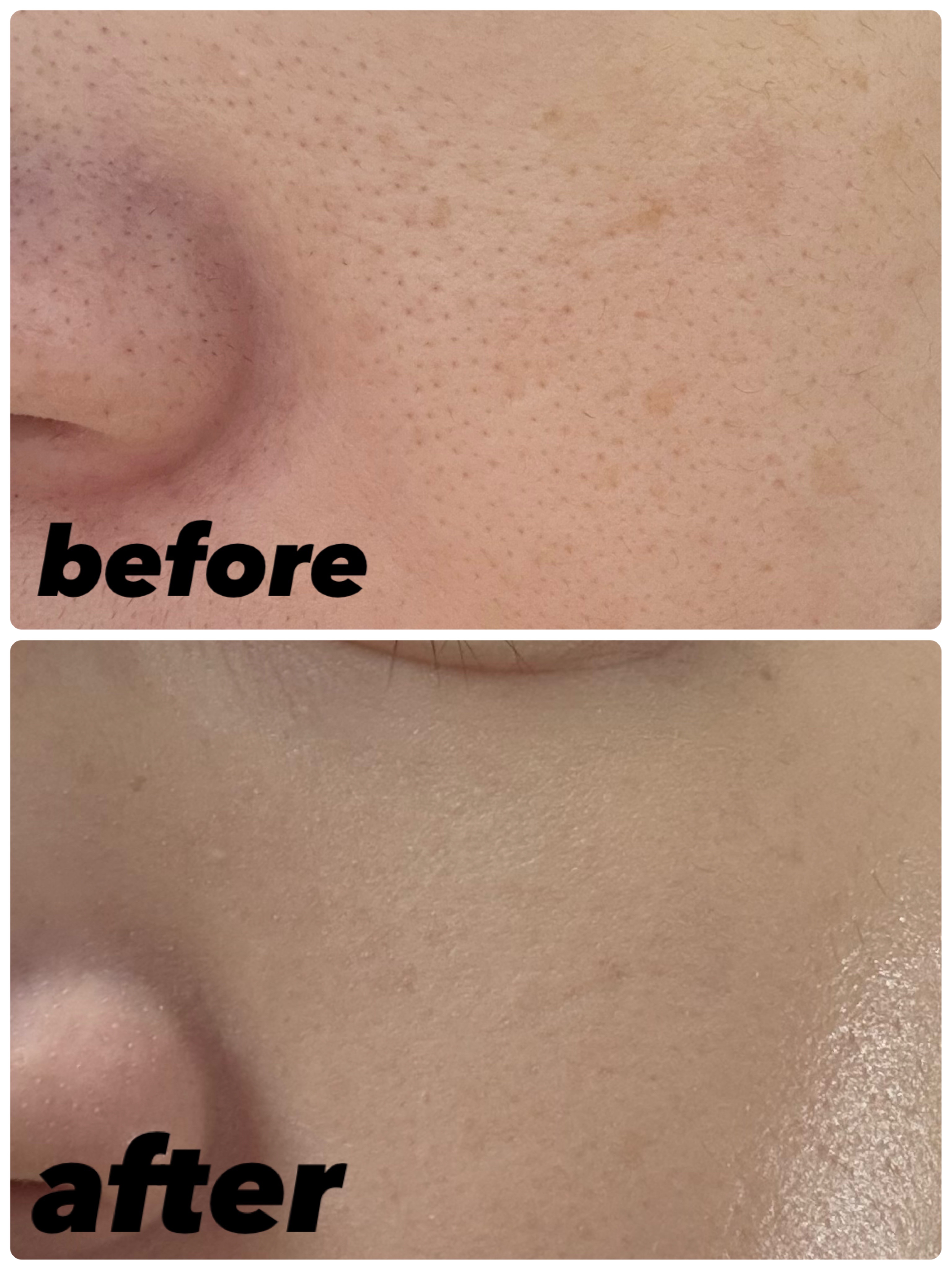 リフレクション スキン グロウ クッション ファンデーション/HERA/クッションファンデーションを使ったクチコミ（3枚目）