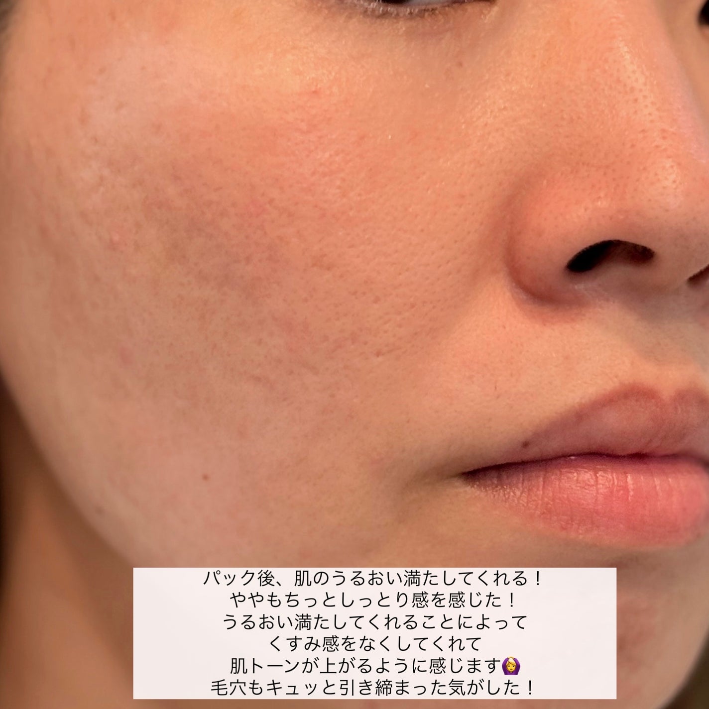 サボリーノ メガショット 夜用白玉美容マスク/サボリーノ/シートマスク・パックを使ったクチコミ(8枚目)