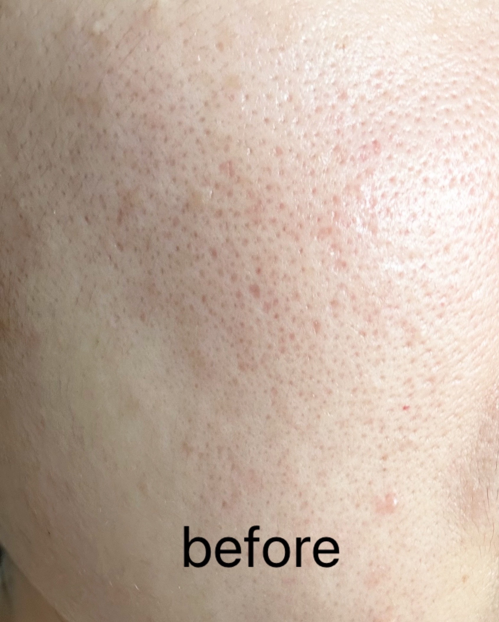 オールアバウトグロウカバークリーム/CHASIN'RABBITS/日焼け止めクリームを使ったクチコミ（3枚目）