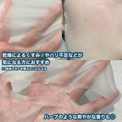 マデカッソシド エッセンシャルマスク/MEDIHEAL/シートマスク・パックを使ったクチコミ(4枚目)