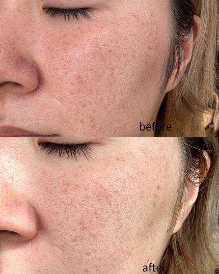 クエスクHQ3セラム/b.glen/美容液を使ったクチコミ(7枚目)