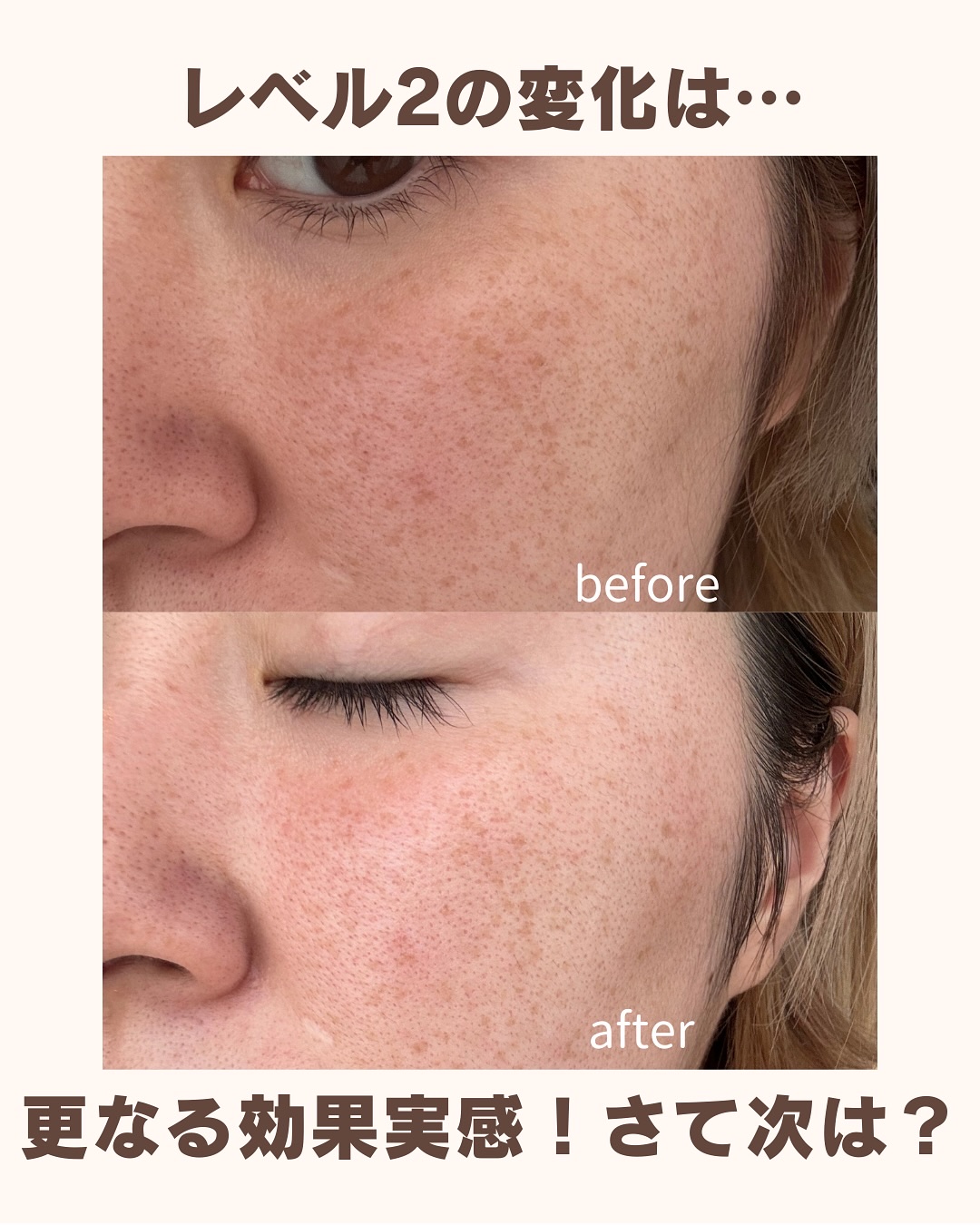 試してみた】クエスクHQ3セラム b.glenの効果・肌質別の口コミ