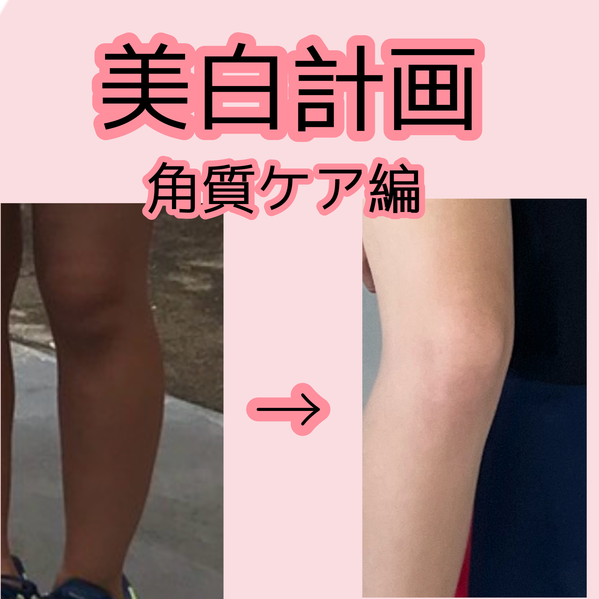 桃セラミド配合ピーリングジェル/DAISO/ピーリングを使ったクチコミ（1枚目）