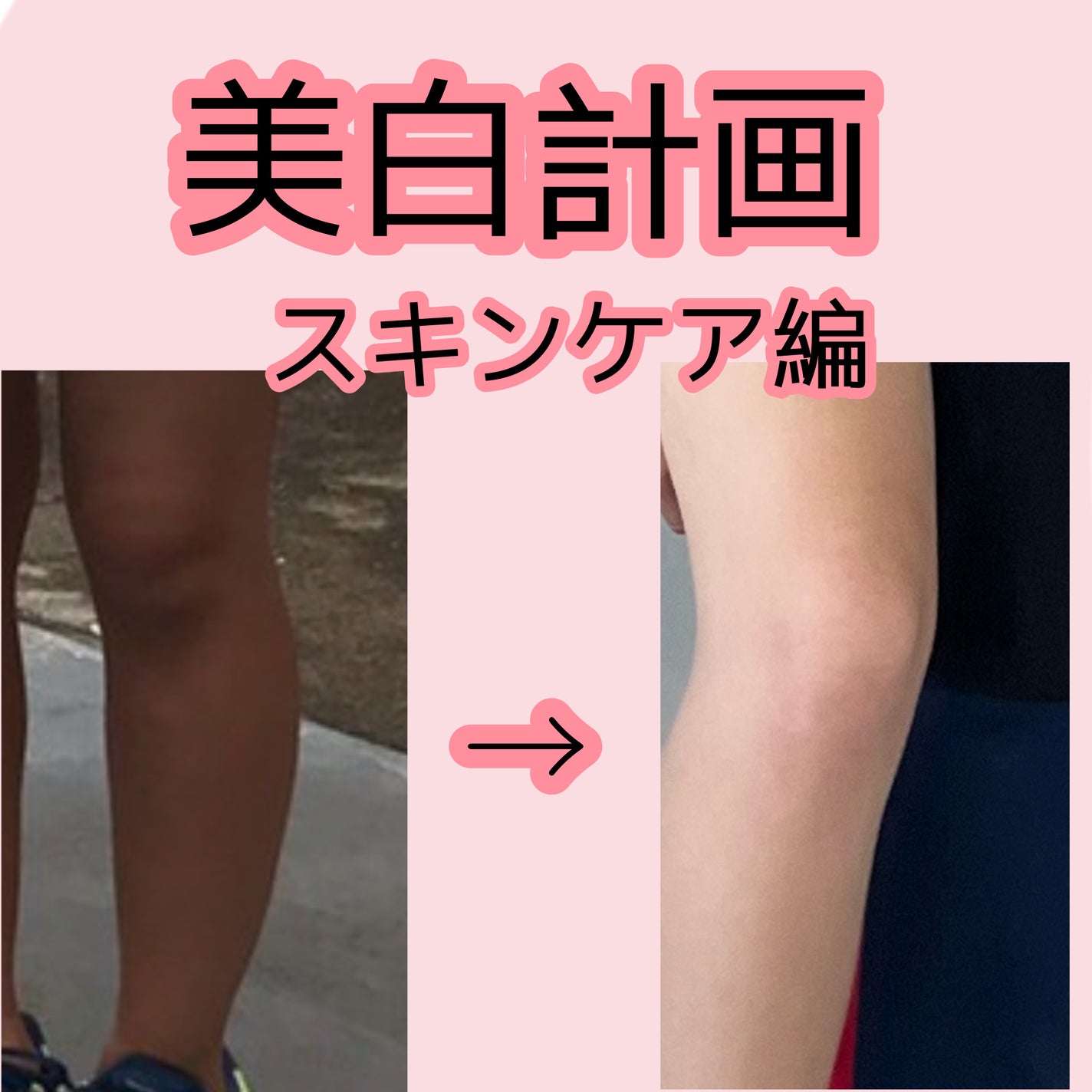 薬用 しみ 集中対策 美容液/メラノCC/美容液を使ったクチコミ(1枚目)