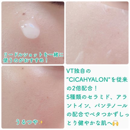 CICA デイリースージングマスク2X/VT/シートマスク・パックを使ったクチコミ(3枚目)