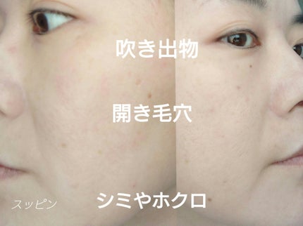 ã¢ã³ãªãããã ã±ã¢ ã〠ã»ã©ã  ãã¡ã³ããŒã·ã§ã³/shu uemura/ãªããããã¡ã³ããŒã·ã§ã³ã䜿ã£ãã¯ãã³ãïŒ3æç®ïŒ