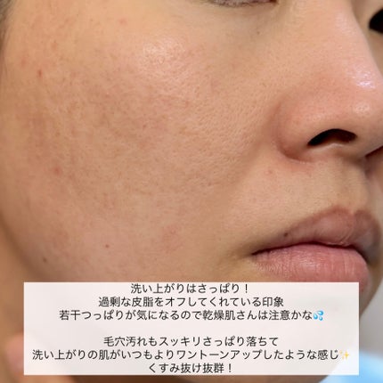 AZケア クレンジングオイル/VT/オイルクレンジングを使ったクチコミ(6枚目)