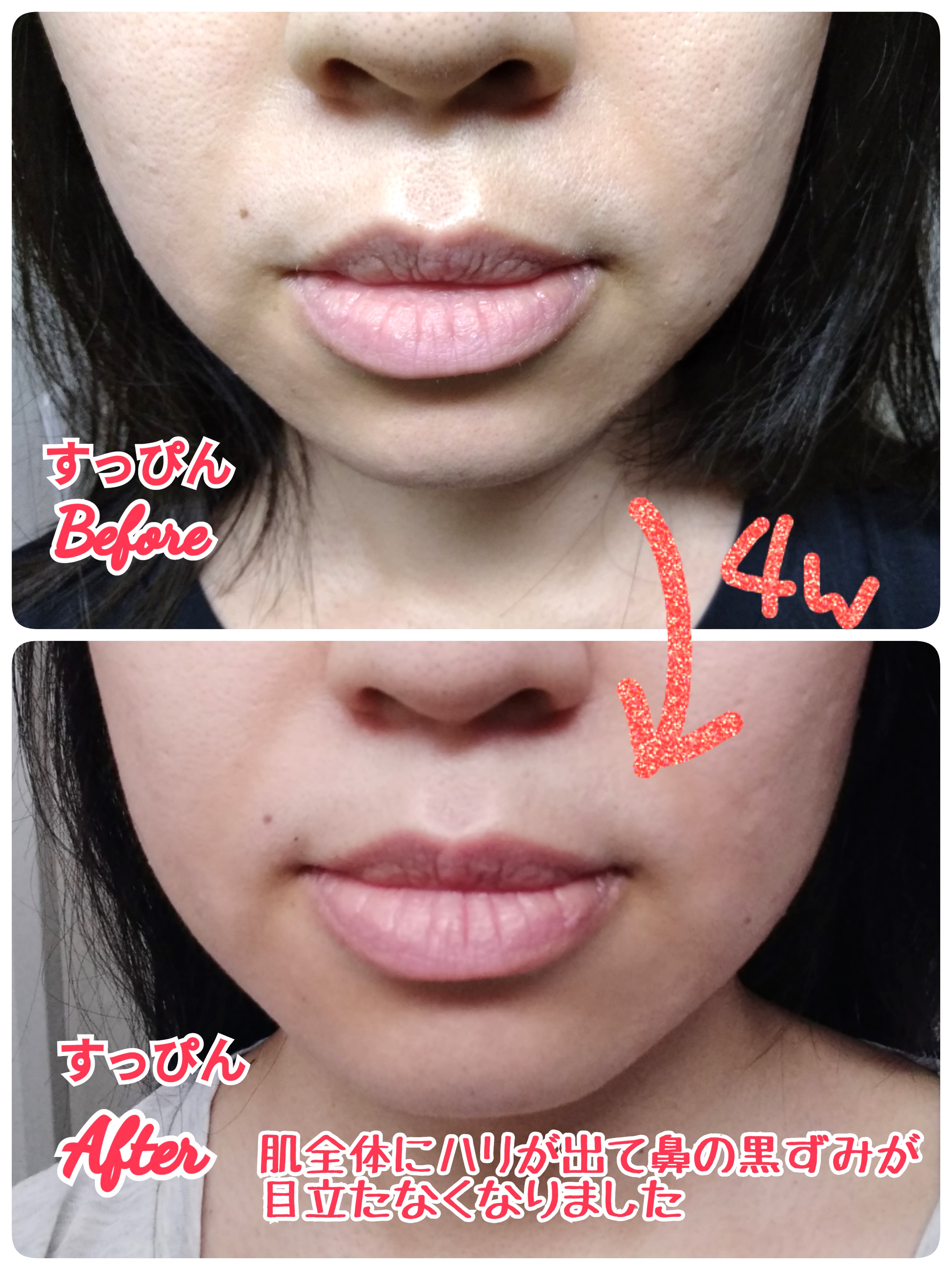 lalaif Booster Serum 1.0/lalaif/ブースター・導入液を使ったクチコミ（3枚目）