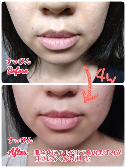 lalaif Booster Serum 1.0/lalaif/ブースター・導入液を使ったクチコミ(3枚目)