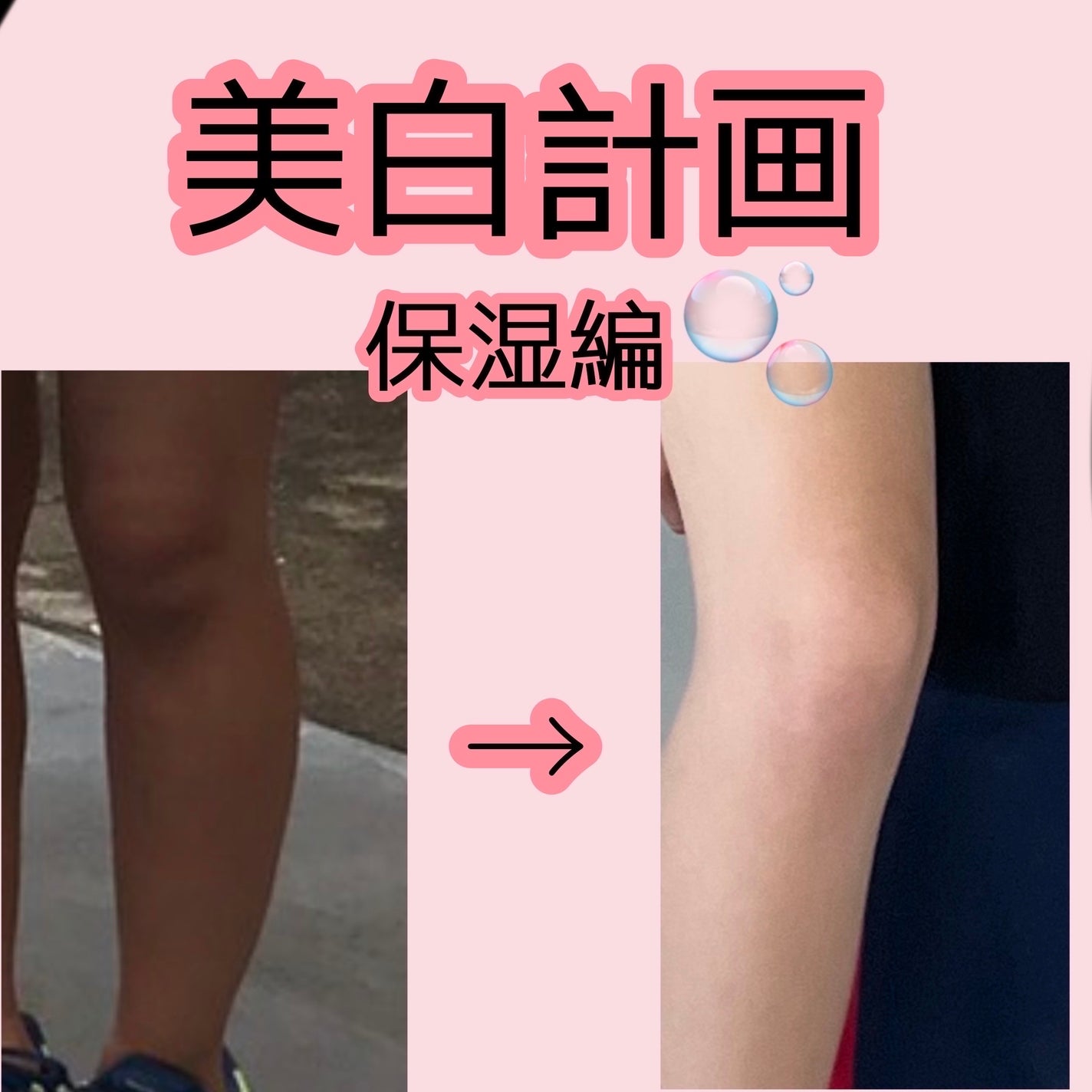 ビタミンC誘導体配合化粧水/ナリス化粧品/化粧水を使ったクチコミ(1枚目)