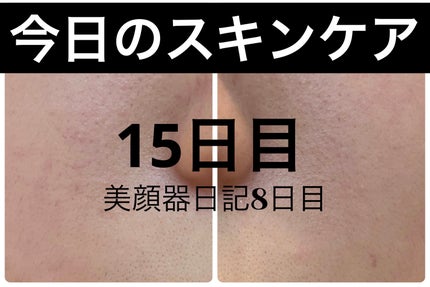 エターナルアイクリーム 8g/リュバンブラン/アイケア・アイクリームを使ったクチコミ(1枚目)