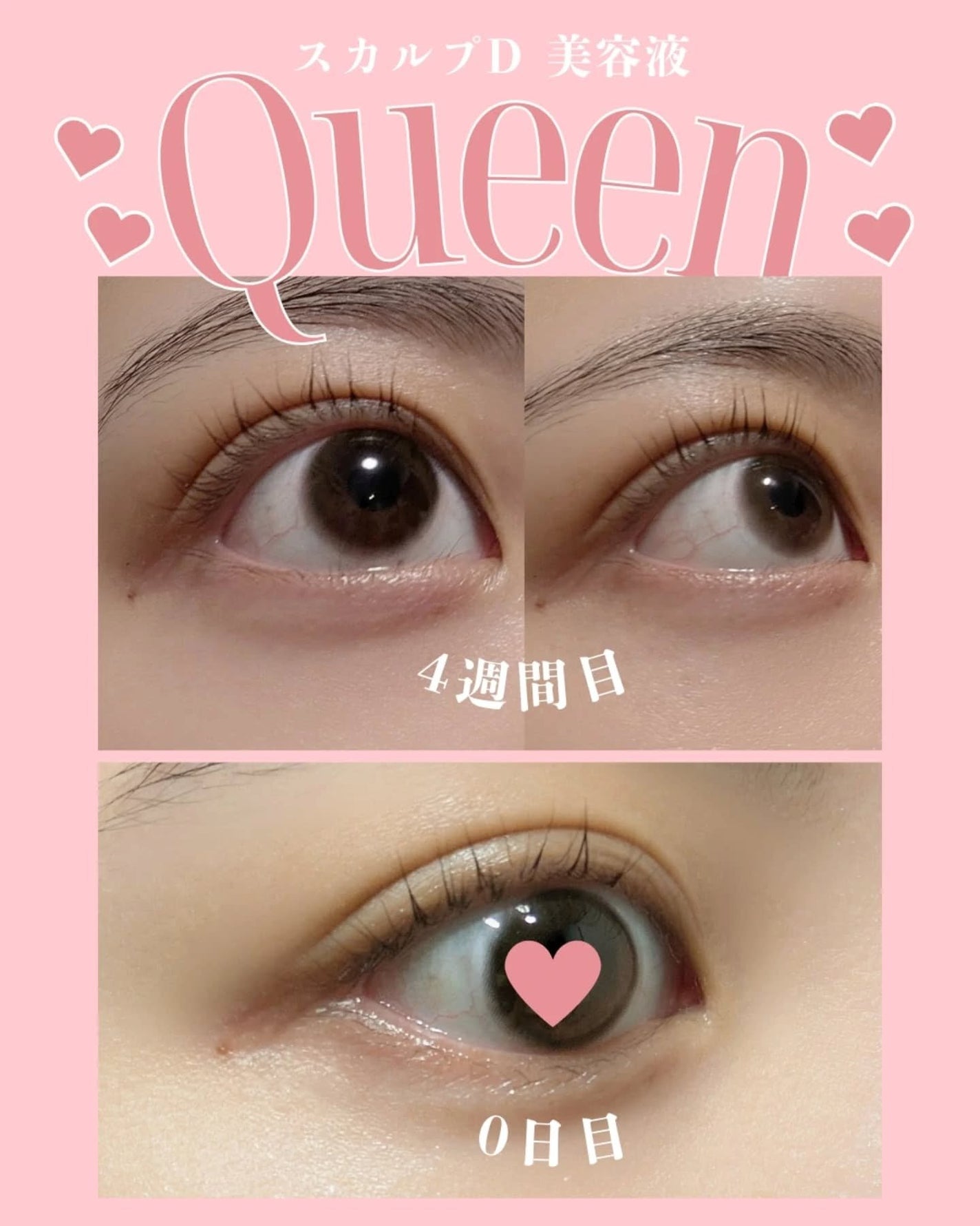スカルプDまつ毛美容液 クイーン/アンファー(スカルプD)/まつげ美容液を使ったクチコミ(2枚目)