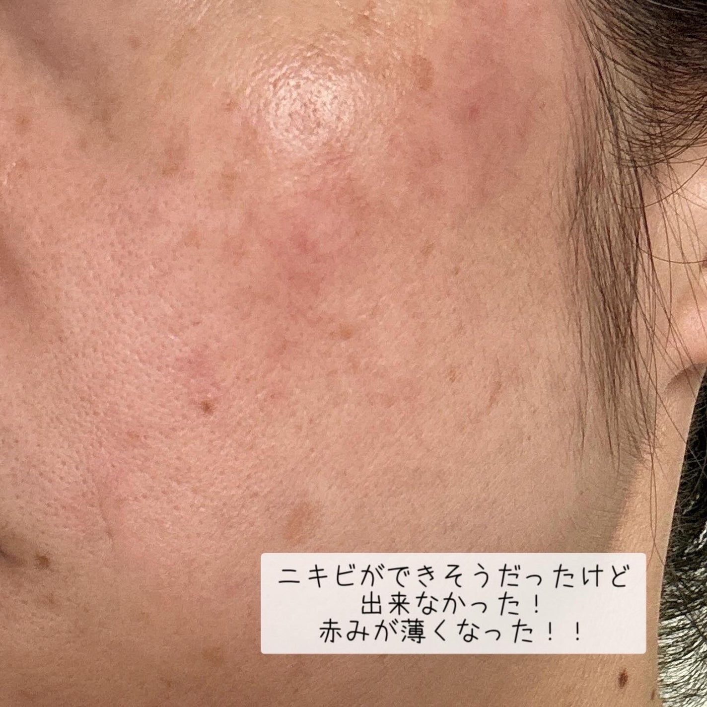 miyukihappy  on LIPS 「韓国で発売早々話題❣️野バラの花水の成分で肌バランスを整えてく..」(4枚目)