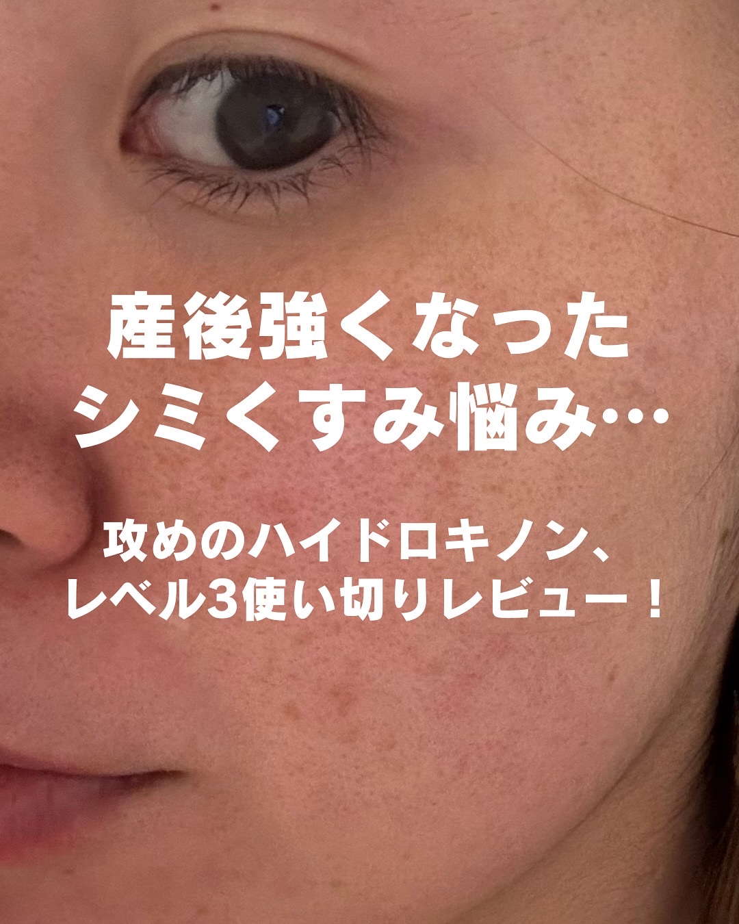 クエスクHQ3セラム/b.glen/美容液を使ったクチコミ（2枚目）