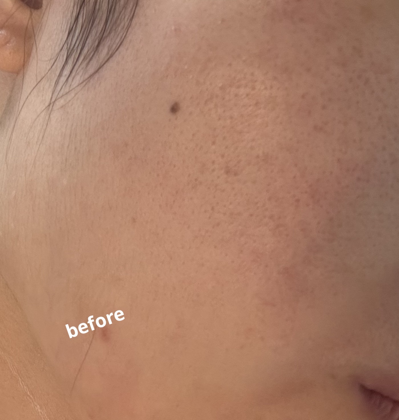 HERA リフレクション スキン グロウ クッション ファンデーションのクチコミ「HERA　リフレクション スキン グロウ クッション ファンデーション21N1 バニラ

この.....」（3枚目）