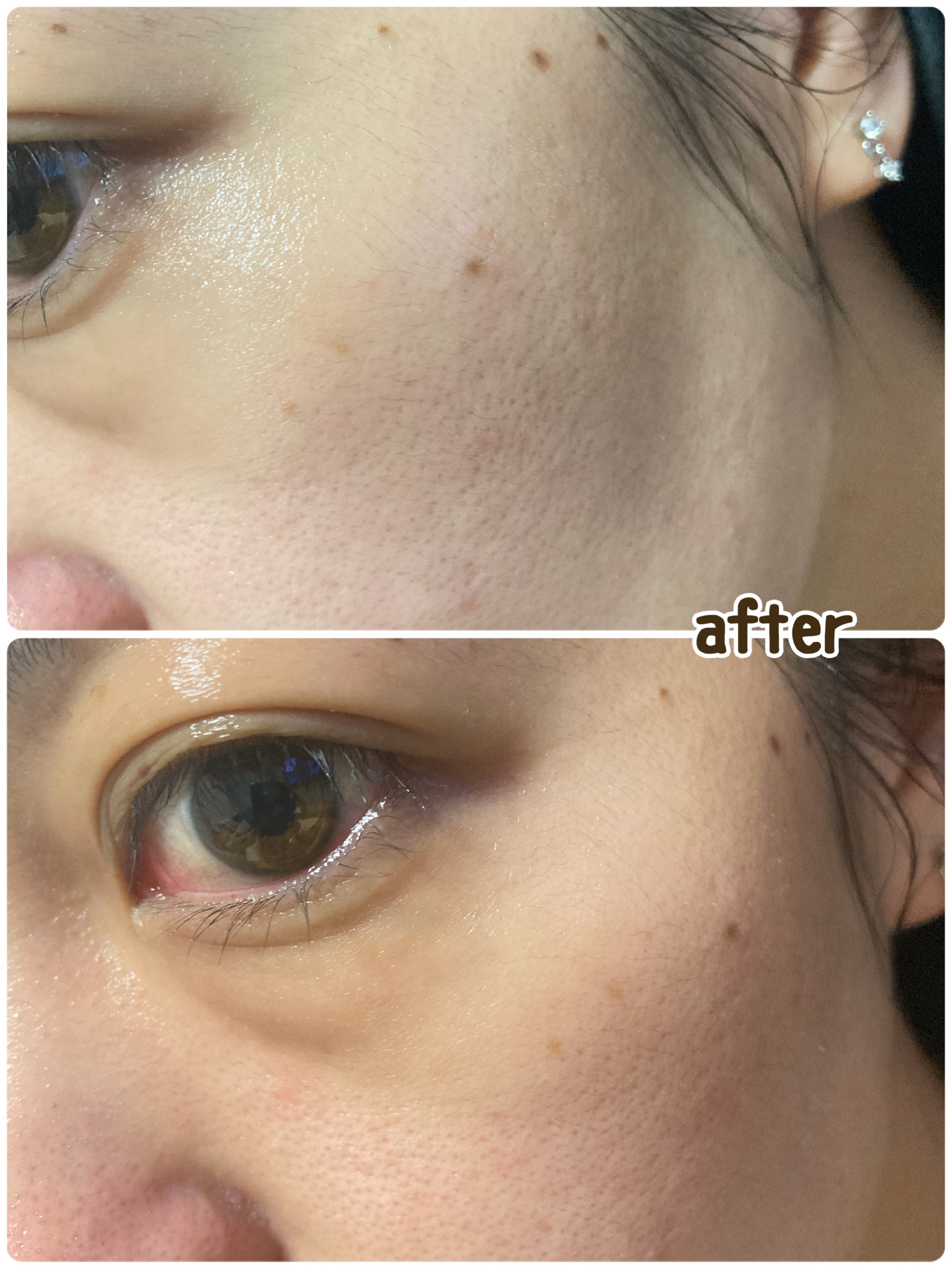 スネイルソリューション スキンブースター(R)/ネイチャーリパブリック/ブースター・導入液を使ったクチコミ（3枚目）