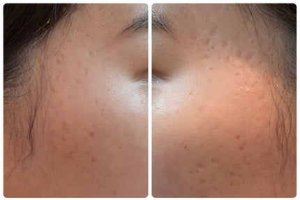 エターナルアイクリーム 8g/リュバンブラン/アイケア・アイクリームを使ったクチコミ(2枚目)