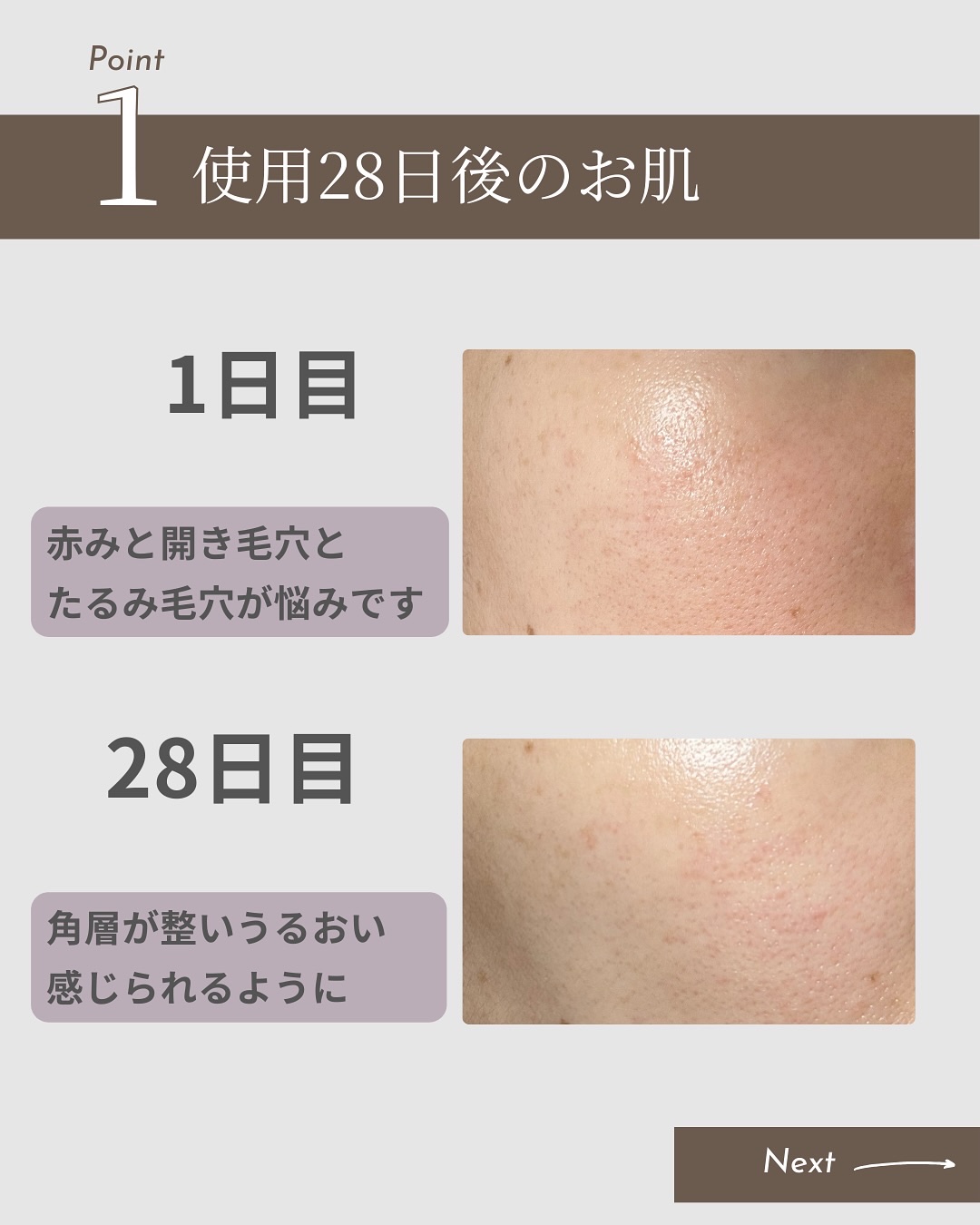 スネイルソリューション スキンブースター(R)/ネイチャーリパブリック/ブースター・導入液を使ったクチコミ（2枚目）