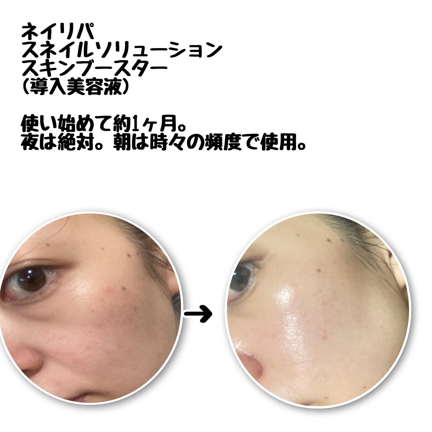 スネイル ソリューション エマルジョン/ネイチャーリパブリック/その他スキンケアを使ったクチコミ(4枚目)