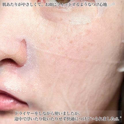 ブラックPDRN デイリーシートマスク/ネイチャーリパブリック/シートマスク・パックを使ったクチコミ(5枚目)