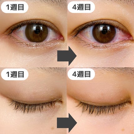 スカルプDまつ毛美容液 クイーン/アンファー(スカルプD)/まつげ美容液を使ったクチコミ(2枚目)