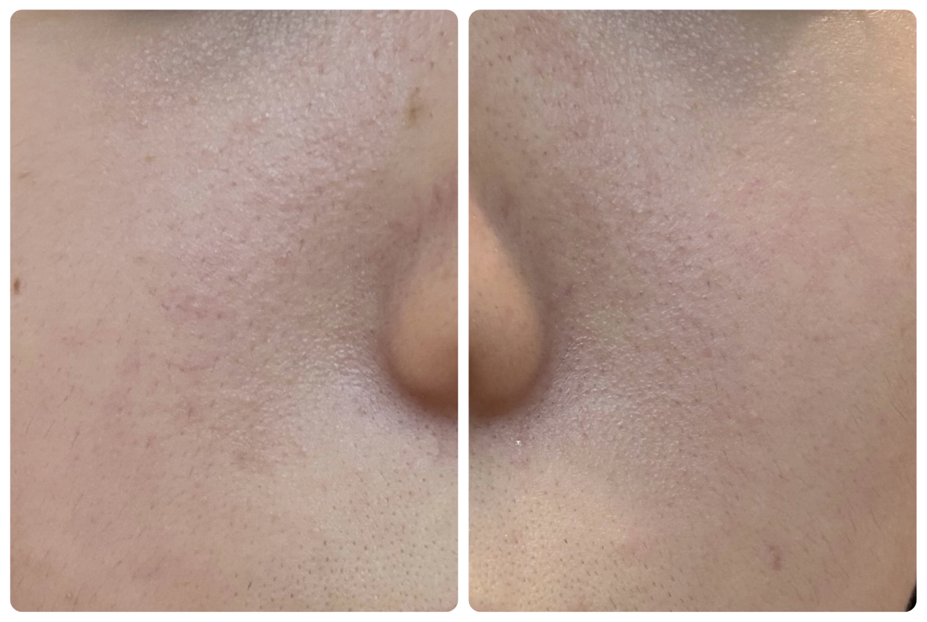 PDRNピンクアンプル PDRN 10,000ppm配合/MEDICUBE/美容液を使ったクチコミ（3枚目）