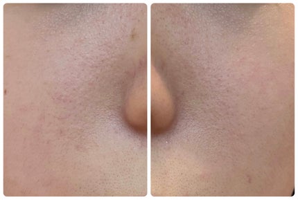 エターナルアイクリーム 8g/リュバンブラン/アイケア・アイクリームを使ったクチコミ(3枚目)